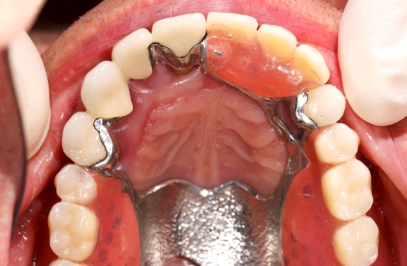 MARTHY ZSUZSA DR. FOGÁSZATI RENDELŐ - CMI DE MEDICINĂ DENTARĂ
