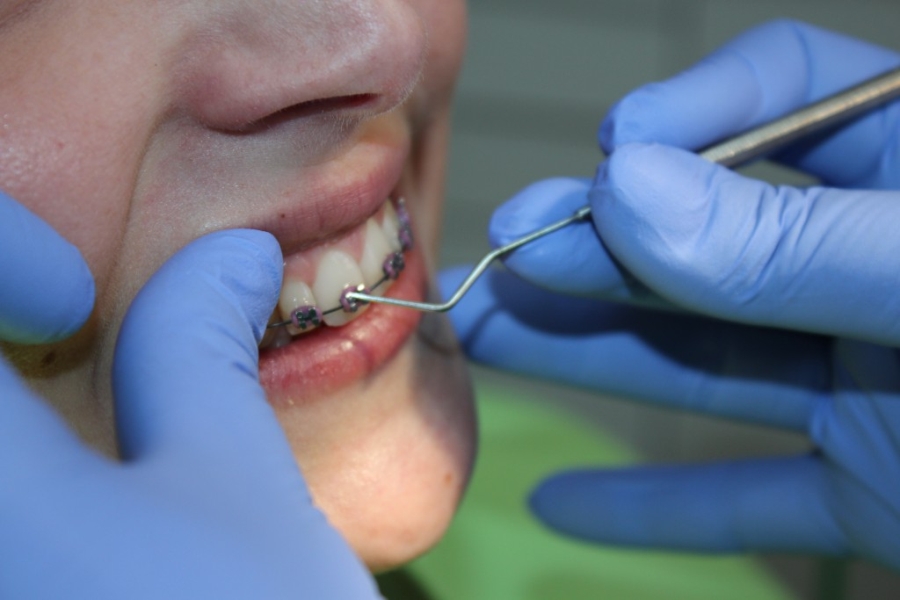 MARTHY ZSUZSA DR. FOGÁSZATI RENDELŐ - CMI DE MEDICINĂ DENTARĂ
